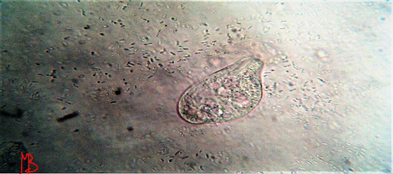 Ciliato da determinare